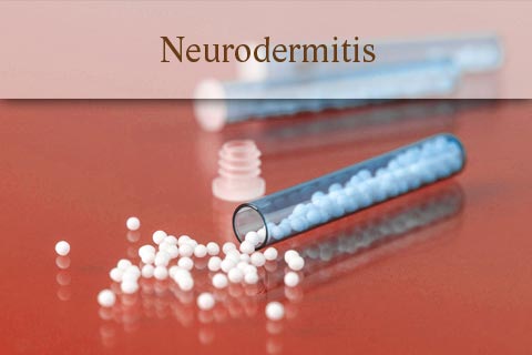 Homöopathie: Globuli bei Neurodermitits