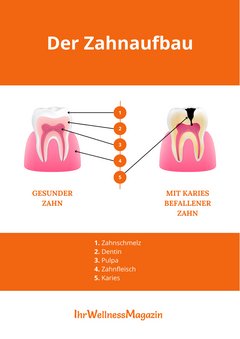 Infografik Zahnerhalt