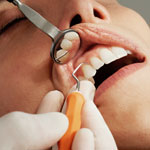 weiter zu - Professionelle Zahnreinigung