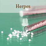 weiter zu - Homöopathie: Globuli bei Herpes