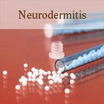 weiter zu - Globuli bei Neurodermitits